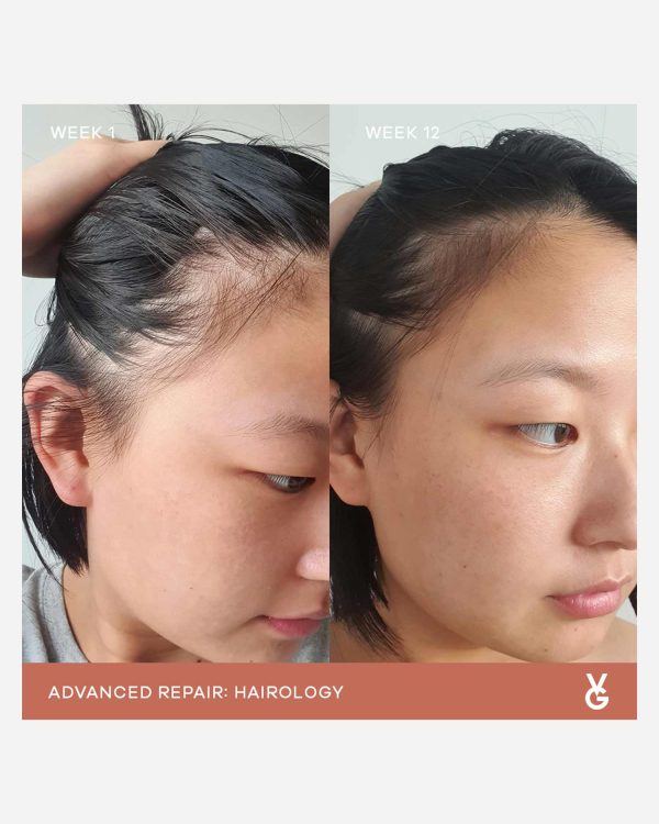 3 VidaGlow Hairology Isabelle Webres | Inigo Cosmetic